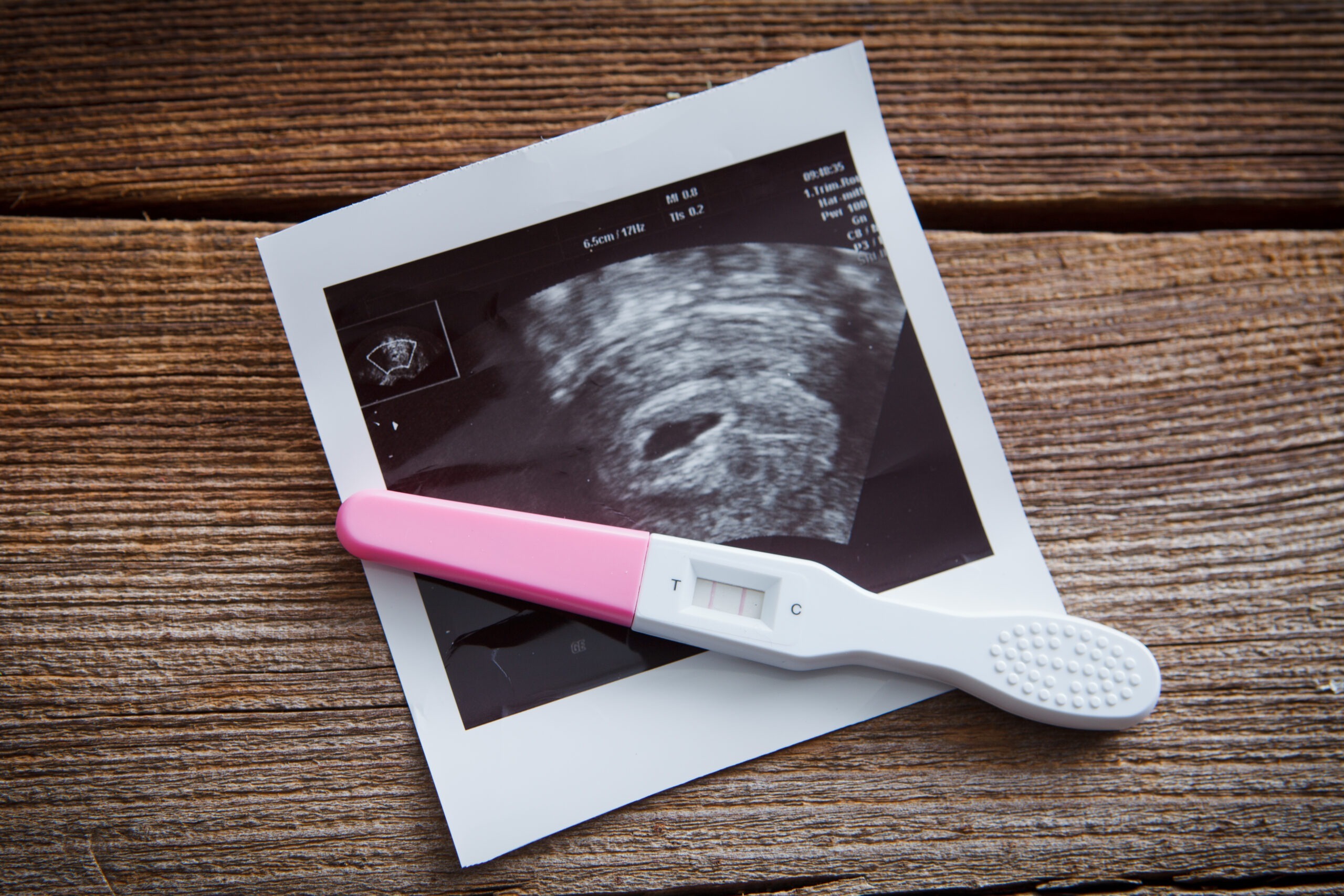 ultrasound page image scaled 1